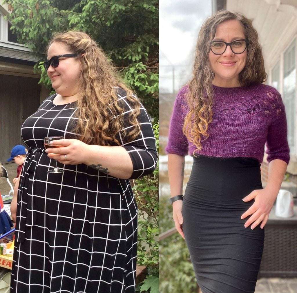 Extra Weight Loss And They Shared Before-And-After