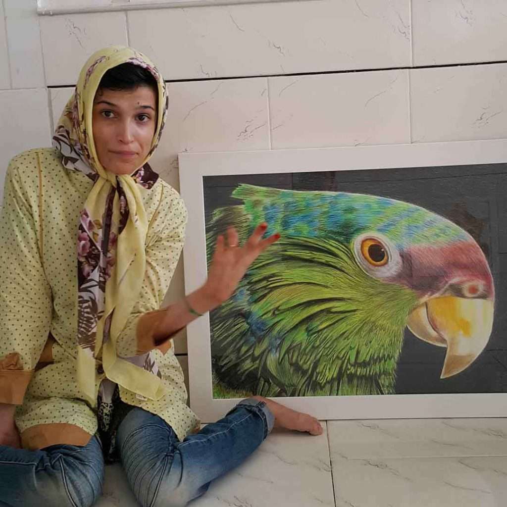 Artist With Disability Defies Odds